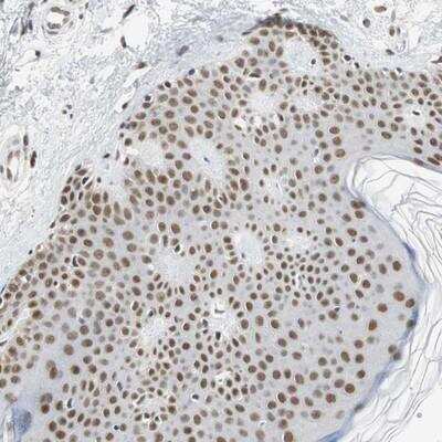 Immunohistochemistry-Paraffin: RTF1 Antibody [NBP1-83019] - Staining of human skin shows strong nuclear positivity in epidermal cells.