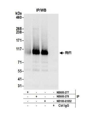 <b>Independent Antibodies Validation. </b>Immunoprecipitation: RTF1 Antibody [NB600-278] - Detection of human Rtf1 by western blot of immunoprecipitates. Samples: Whole cell lysate (1.0 mg per IP reaction; 20% of IP loaded) from HeLa cells prepared using NETN lysis buffer. Antibodies: Affinity purified rabbit anti-Rtf1 antibody NB600-278 used for IP at 3 ug per reaction. Rtf1 was also immunoprecipitated by rabbit anti-RTF1 antibodies NB600-277 and NB100-61052. For blotting immunoprecipitated Rtf1, NB600-278 was used at 1 ug/ml. Detection: Chemiluminescence with an exposure time of 10 seconds.