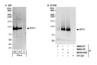 Western Blot: RTF1 Antibody [NB600-277] - Detection of human RTF1 by western blot and immunoprecipitation. Samples: Whole cell lysate (5, 15 and 50 ug for WB; 1 mg for IP, 20% of IP loaded) from HeLa cells. Antibodies: Affinity purified rabbit anti-RTF1 antibody NB600-277 used for WB at 0.4 ug/ml (A) and 1 ug/ml (B) and used for IP at 3 ug/mg lysate. RTF1 was successfully immunoprecipitated by rabbit anti-RTF1 antibodies NB600-278 and NB100-61052, which recognize downstream epitopes. Detection: Chemiluminescence with exposure times of 3 minutes (A) and 30 seconds (B).