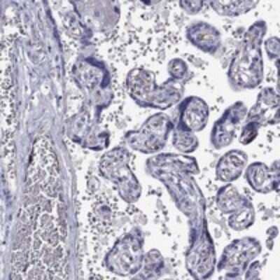Immunohistochemistry-Paraffin: RTL1 Antibody [NBP3-17617] - Staining of human placenta shows moderate membranous positivity in endothelial cells.