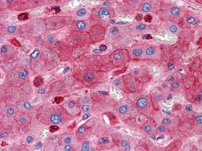 Immunohistochemistry-Paraffin: RTN3 Antibody (10A8) [NBP1-47353] - Immunohistochemical analysis of paraffin-embedded human Liver tissues using RTN3 mouse mAb