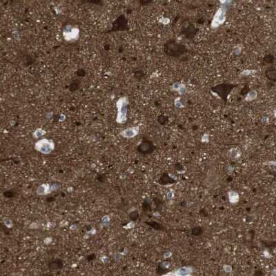 Immunohistochemistry-Paraffin: RTN3 Antibody [NBP1-88870] - Staining of human cerebral cortex shows strong cytoplasmic positivity in neurons.