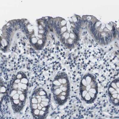 Immunohistochemistry-Paraffin: RTN3 Antibody [NBP1-88870] - Staining of human colon shows no positivity in glandular cells as expected.