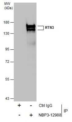 Immunoprecipitation: RTN3 Antibody [NBP3-12988] - Immunoprecipitation of RTN3 protein from HeLa whole cell extracts using 5 ug of RTN3 antibody (NBP3-12988). Western blot analysis was performed using RTN3 antibody (NBP3-12988) diluted at 1:500. EasyBlot anti-Rabbit IgG was used as a secondary reagent.