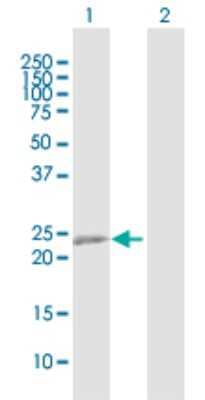 Western Blot: RTN3 Antibody [H00010313-B01P] - Analysis of RTN3 expression in transfected 293T cell line by RTN3 polyclonal antibody.  Lane 1: RTN3 transfected lysate(25.96 KDa). Lane 2: Non-transfected lysate.