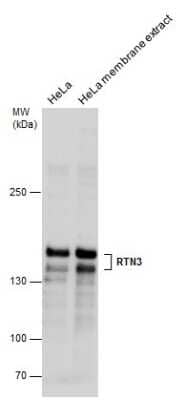 Western Blot: RTN3 Antibody [NBP3-12988] - RTN3 antibody detects RTN3 protein by western blot analysis. HeLa whole cell extracts and membrane extracts (30 ug) were separated by 5% SDS-PAGE, and the membrane was blotted with RTN3 antibody (NBP3-12988) diluted at 1:500.