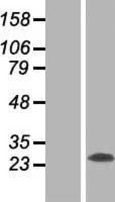 Western Blot: RTN3 Overexpression Lysate (Adult Normal) [NBP2-07679] Left-Empty vector transfected control cell lysate (HEK293 cell lysate); Right -Over-expression Lysate for RTN3.