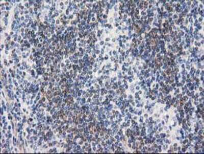 Immunohistochemistry-Paraffin: RTN4IP1 Antibody (3B2) [NBP2-00478] - Staining of paraffin-embedded Human lymphoma tissue using anti-RTN4IP1 mouse monoclonal antibody.