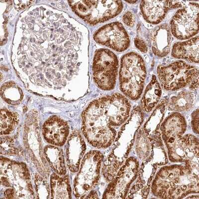 Immunohistochemistry-Paraffin: RTN4IP1 Antibody [NBP1-82568] - Staining of human kidney shows strong cytoplasmic positivity in tubule cells.