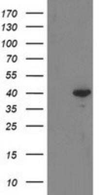 Western Blot: RTN4IP1 Antibody (OTI3B2) - Azide and BSA Free [NBP2-73952] - HEK293T cells were transfected with the pCMV6-ENTRY control (Left lane) or pCMV6-ENTRY RTN4IP1 (Right lane) cDNA for 48 hrs and lysed. Equivalent amounts of cell lysates (5 ug per lane) were separated by SDS-PAGE and immunoblotted with anti-RTN4IP1.