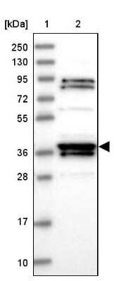 Western Blot: RTN4IP1 Antibody [NBP1-82568] - Lane 1: Marker  [kDa] 250, 130, 95, 72, 55, 36, 28, 17, 10.  Lane 2: Human cell line RT-4