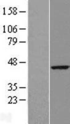 Western Blot: RTN4IP1 Overexpression Lysate (Adult Normal) [NBL1-15613] Left-Empty vector transfected control cell lysate (HEK293 cell lysate); Right -Over-expression Lysate for RTN4IP1.