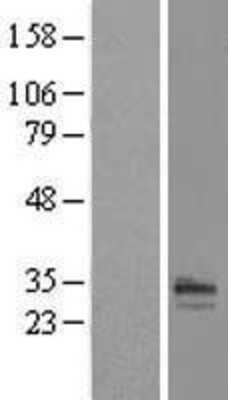 Western Blot: RTP1 Overexpression Lysate (Adult Normal) [NBL1-15615] Left-Empty vector transfected control cell lysate (HEK293 cell lysate); Right -Over-expression Lysate for RTP1.