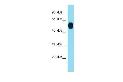 Western Blot RTP3 Antibody