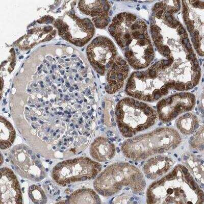 Immunohistochemistry-Paraffin: RTVP-1/GLIPR1 Antibody [NBP1-81825] - Staining of human kidney shows strong granular cytoplasmic positivity in cells in tubules.
