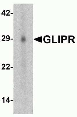 Western Blot RTVP-1/GLIPR1 Antibody - BSA Free