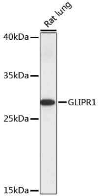 Western Blot: RTVP-1/GLIPR1 Antibody [NBP2-94550] - Analysis of extracts of rat lung, using RTVP-1/GLIPR1 at 1:1000 dilution.Secondary antibody: HRP Goat Anti-Rabbit IgG (H+L) at 1:10000 dilution.Lysates/proteins: 25ug per lane.Blocking buffer: 3% nonfat dry milk in TBST.Detection: ECL Basic Kit .Exposure time: 10s.