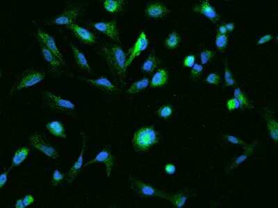 Immunocytochemistry/Immunofluorescence: RUBCNL Antibody [NBP2-98088] - Immunofluorescence staining of RUBCNL in U251MG cells. Cells were fixed with 4% PFA, permeabilzed with 0.1% Triton X-100 in PBS, blocked with 10% serum, and incubated with rabbit anti-Human RUBCNL polyclonal antibody (dilution ratio 1:200) at 4C overnight. Then cells were stained with the Alexa Fluor(R)488-conjugated Goat Anti-rabbit IgG Secondary antibody (green) and counterstained with DAPI (blue).Positive staining was localized to Cytoplasm.