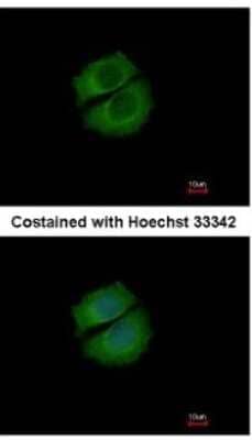 Immunocytochemistry/Immunofluorescence: RUFY1 Antibody [NBP2-20241] - Analysis of methanol-fixed MCF-7, using antibody at 1:200 dilution.