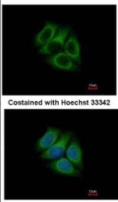 Immunocytochemistry/Immunofluorescence: RUFY1 Antibody [NBP2-20242] - Immunofluorescence analysis of methanol-fixed MCF-7, using antibody at 1:500 dilution.