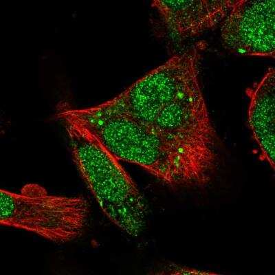 Immunocytochemistry/Immunofluorescence: RUFY1 Antibody [NBP2-76553] - Staining of human cell line U-251 MG shows localization to nucleus, cytosol & vesicles. Antibody staining is shown in green.