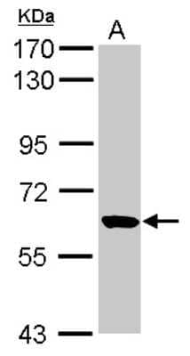 Western Blot: RUFY1 Antibody [NBP2-20241] - Sample (30 ug of whole cell lysate) A: NT2D1 7. 5% SDS PAGE gel, diluted at 1:1000.