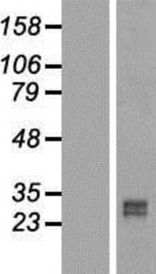 Western Blot: RUNDC2B Overexpression Lysate (Adult Normal) [NBL1-15622] Left-Empty vector transfected control cell lysate (HEK293 cell lysate); Right -Over-expression Lysate for RUNDC2B.