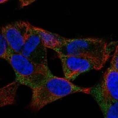 Immunocytochemistry/Immunofluorescence: RUNDC3B Antibody [NBP3-17306] - Staining of human cell line SH-SY5Y shows localization to cytosol & vesicles.