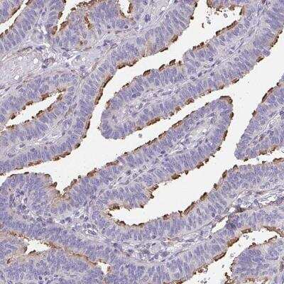 Immunohistochemistry-Paraffin: RUNDC3B Antibody [NBP2-31654] - Staining of human fallopian tube shows strong positivity in cilia of glandular cells.