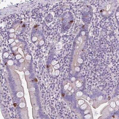 Immunohistochemistry-Paraffin: RUNDC3B Antibody [NBP2-31661] - Staining of human small intestine shows strong cytoplasmic positivity in endocrine cells.