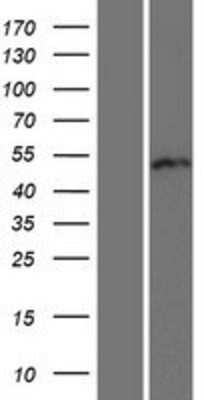 Western Blot: RUNDC3B Overexpression Lysate (Adult Normal) [NBP2-05679] Left-Empty vector transfected control cell lysate (HEK293 cell lysate); Right -Over-expression Lysate for RUNDC3B.