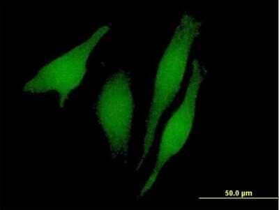 Immunocytochemistry/Immunofluorescence: RUSC1 Antibody [H00023623-B01P] - Analysis of purified antibody to RUSC1 on HeLa cell. (antibody concentration 10 ug/ml)