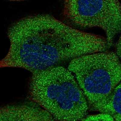 Immunocytochemistry/Immunofluorescence: RUSC1 Antibody [NBP1-81004] - Staining of human cell line A-431 shows positivity in cytoplasm.