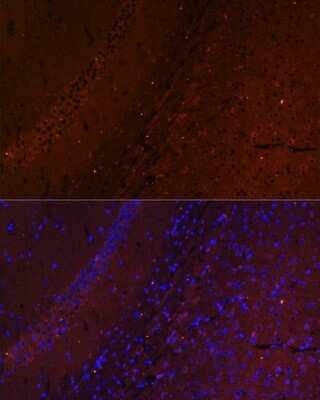 Immunohistochemistry: RUSC1 Antibody [NBP2-93950] - Analysis of mouse brain using RUSC1 at dilution of 1:100. Blue: DAPI for nuclear staining.