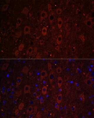 Immunohistochemistry: RUSC1 Antibody [NBP2-93950] - Analysis of mouse brain using RUSC1 at dilution of 1:100. Blue: DAPI for nuclear staining.