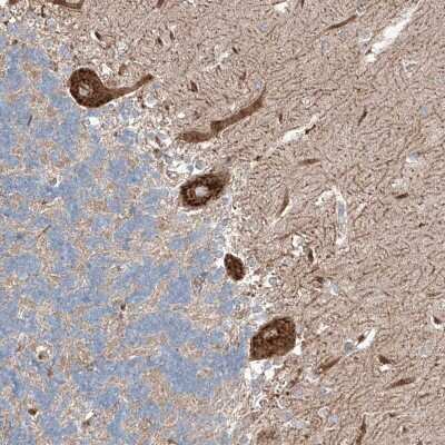 Immunohistochemistry-Paraffin RUSC1 Antibody