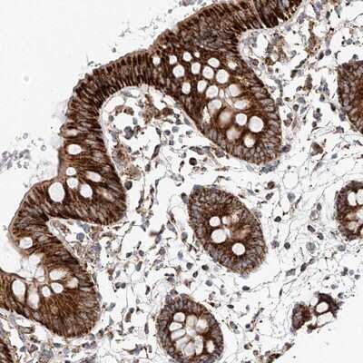 Immunohistochemistry-Paraffin: RUSC1 Antibody [NBP1-81006] - Staining of human colon shows strong cytoplasmic positivity (granular pattern) in glandular cells.