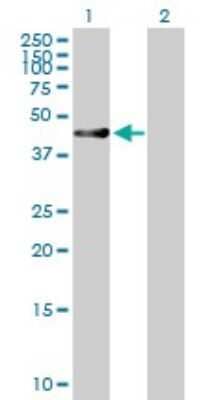 Western Blot: RUSC1 Antibody [H00023623-B01P] - Analysis of RUSC1 expression in transfected 293T cell line by RUSC1 polyclonal antibody.  Lane1:RUSC1 transfected lysate(47.63 KDa). Lane2:Non-transfected lysate.