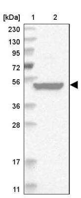 Western Blot RUSC1 Antibody