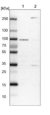 Western Blot: RUSC1 Antibody [NBP1-81005] - Lane 1: NIH-3T3 cell lysate (Mouse embryonic fibroblast cells). Lane 2: NBT-II cell lysate (Rat Wistar bladder tumor cells).