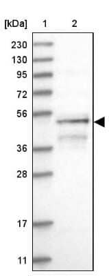 Western Blot: RUSC1 Antibody [NBP1-81006] - Lane 1: Marker  [kDa] 230, 130, 95, 72, 56, 36, 28, 17, 11.  Lane 2: Human cell line RT-4.