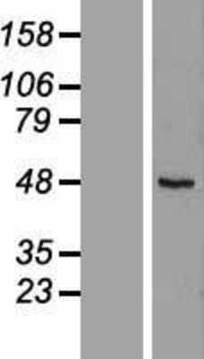 Western Blot RUSC1 Overexpression Lysate