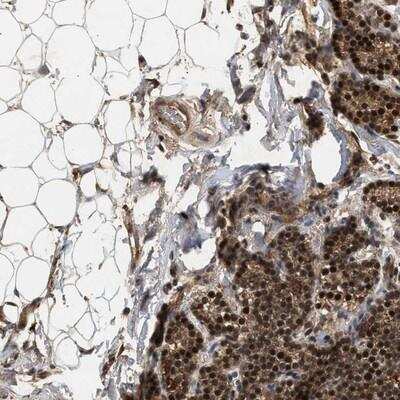 Immunohistochemistry RUSC2 Antibody - BSA Free
