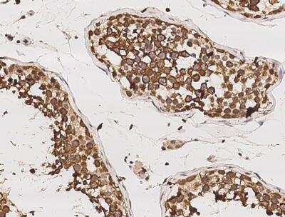 Immunohistochemistry-Paraffin: RUVBL1 Antibody (01) [NBP3-06522] - Staining of human RUVBL1 in human testis with mouse monoclonal antibody (1:100000).