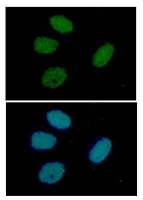 Immunocytochemistry/Immunofluorescence: RUVBL1 Antibody (1D6) [NBP2-59456] - Analysis of RuVBL in HeLa cells line, stained with DAPI (Blue) for nucleus staining and monoclonal anti-human   RuVBL antibody (1:100) with goat anti-mouse IgG-Alexa fluor 488 conjugate (Green).