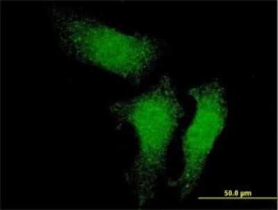 Immunocytochemistry/Immunofluorescence: RUVBL1 Antibody (3G4-1F8) [H00008607-M01] - Analysis of monoclonal antibody to RUVBL1 on HeLa cell . Antibody concentration 10 ug/ml.