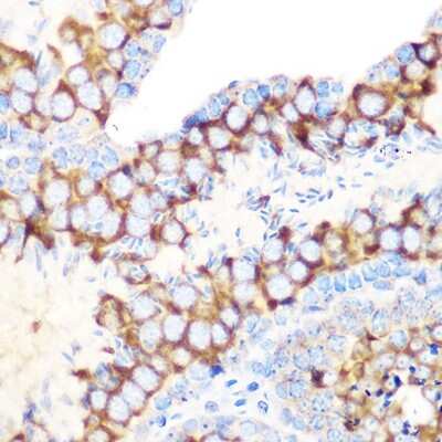 Immunohistochemistry-Paraffin: RUVBL1 Antibody (7Q2U8) [NBP3-16583] - Immunohistochemistry of paraffin-embedded mouse testis using RUVBL1 Rabbit mAb (NBP3-16583) at dilution of 1:100 (40x lens).Perform microwave antigen retrieval with 10 mM Tris/EDTA buffer pH 9.0 before commencing with IHC staining protocol.