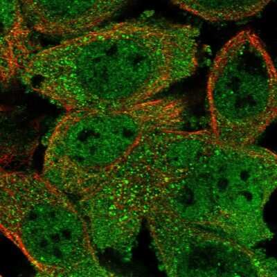 <b>Genetic Strategies Validation. </b>Immunocytochemistry/Immunofluorescence: RUVBL1 Antibody [NBP1-84914] - Staining of human cell line A-431 shows localization to nucleoplasm & cytosol.  Antibody staining is shown in green.