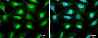 Immunocytochemistry/Immunofluorescence: RUVBL1 Antibody [NBP2-20245] - HeLa cells were fixed in 4% paraformaldehyde at RT for 15 min. Green: RUVBL1 protein stained by RUVBL1 antibody diluted at 1:500. Blue: Hoechst 33342 staining. Scale bar = 10 um.