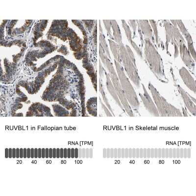 <b>Orthogonal Strategies Validation. </b>Immunohistochemistry-Paraffin: RUVBL1 Antibody [NBP1-84913] - Staining in human fallopian tube and skeletal muscle tissues using anti-RUVBL1 antibody. Corresponding RUVBL1 RNA-seq data are presented for the same tissues.